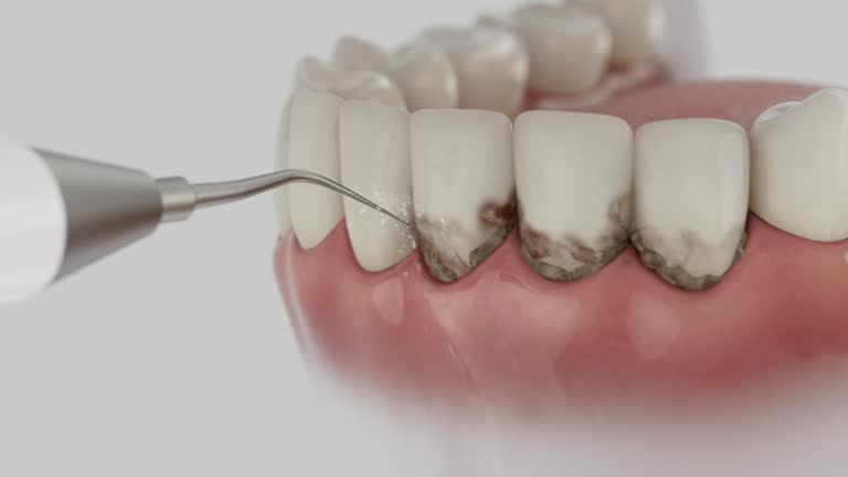 Reliable Dental Implants contractor in Phoenix, IL by Smile Center Dentistry
